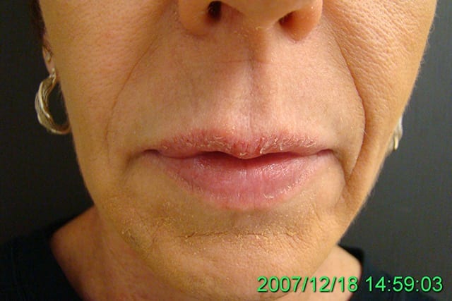 Non-surgical patient before