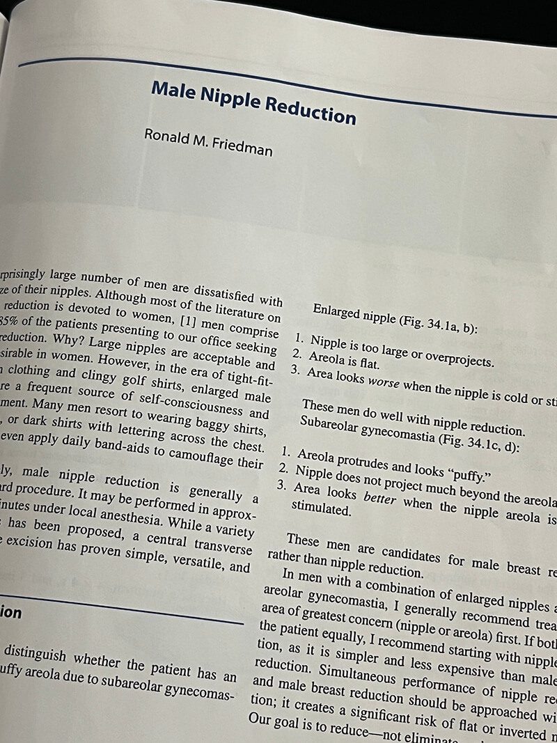 Male Nipple Reduction by Ronald M. Friedman