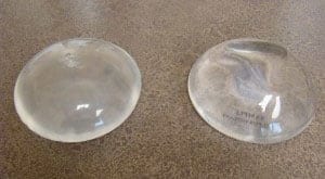 Example of breast implants