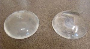 Silicone Breast Implants