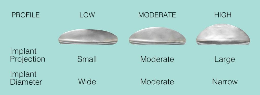 Breast Implants Visual and Size | Ronald M. Friedman