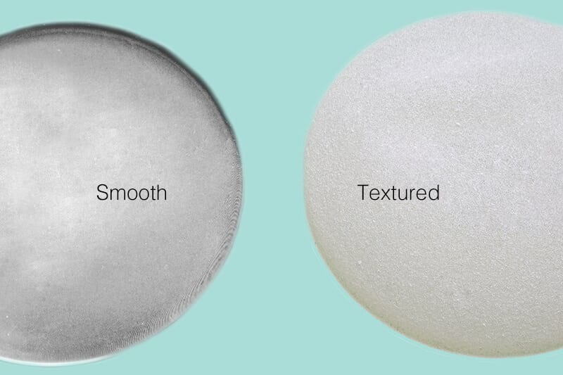 Breast Implants Texture Vs. Smooth | Ronald M. Friedman