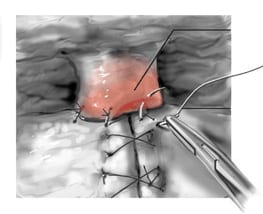 Muscle Visual Diagram | Ronald M. Friedman M.D