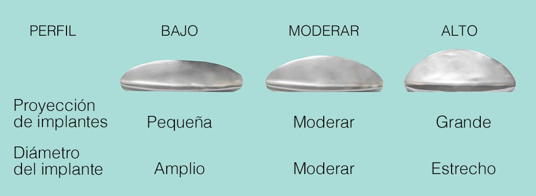 Implant profile comparison